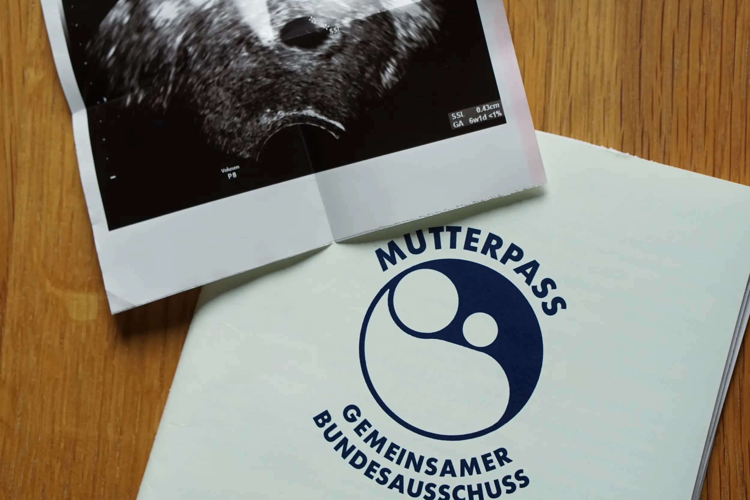 Schwangerschaft erster Ultraschall vom Baby Mutterpass